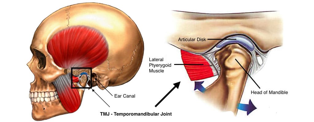 Tmj Total Joint Replacement