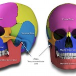 Craniofacial Surgery Hemifacial Microsomia, Treacher Collins Syndrome Crouzon`s Syndrome, Apert`s Syndrome, Cleft Lip And Palate Deformities