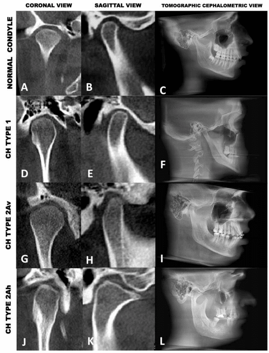 Cbct Of Tmjs Fig 29