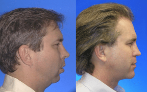 Larry M. Wolford, Dmd - Oral And Maxillofacial Surgery