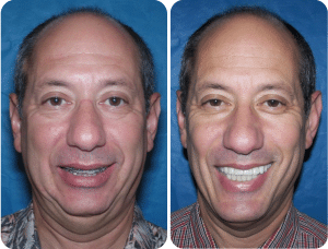 Larry M. Wolford, Dmd - Oral And Maxillofacial Surgery