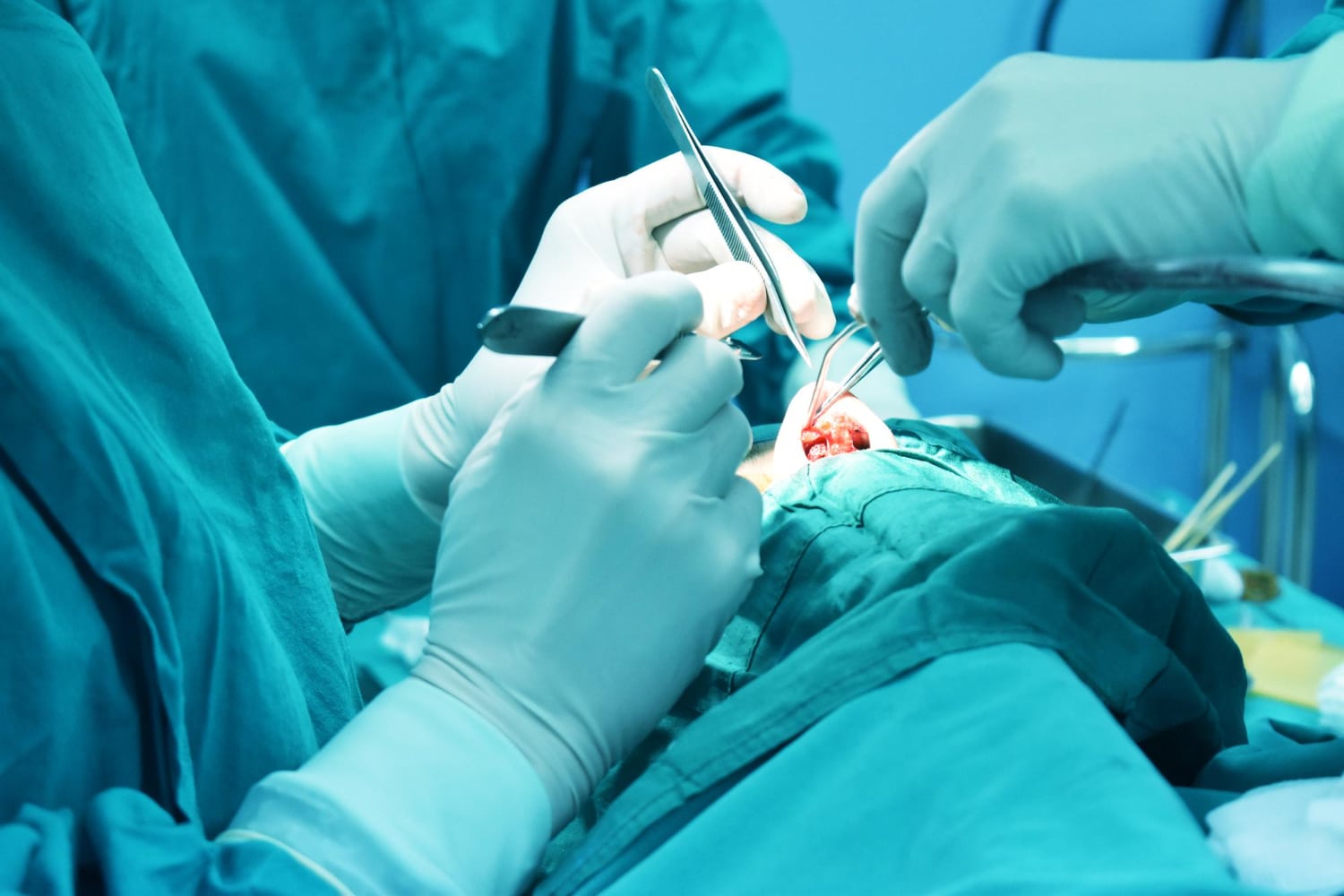 When Is Tmj Surgery Necessary?