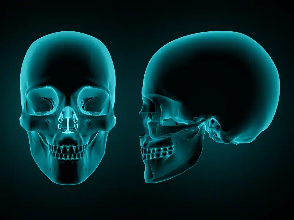 Jaw Re Surgery And Jaw Surgeon Fishers In Jaw Re-Surgery And Jaw Surgeon
