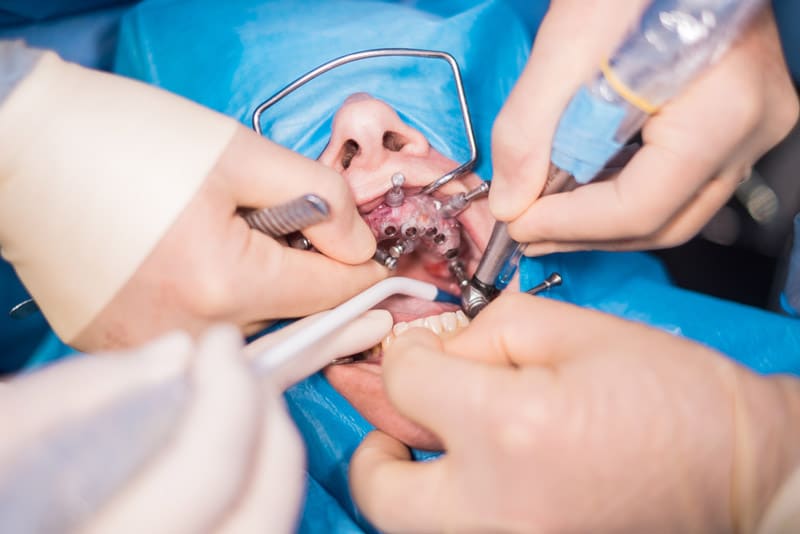Oral & Maxillofacial Surgery and Normal Oral Surgery