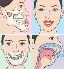 Reasons why patients choose maxillofacial surgery