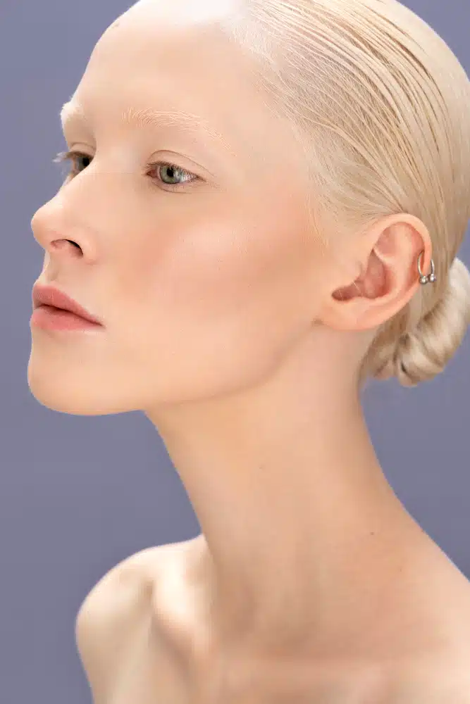 Revisional Orthognathic Surgery Decatur, Ga