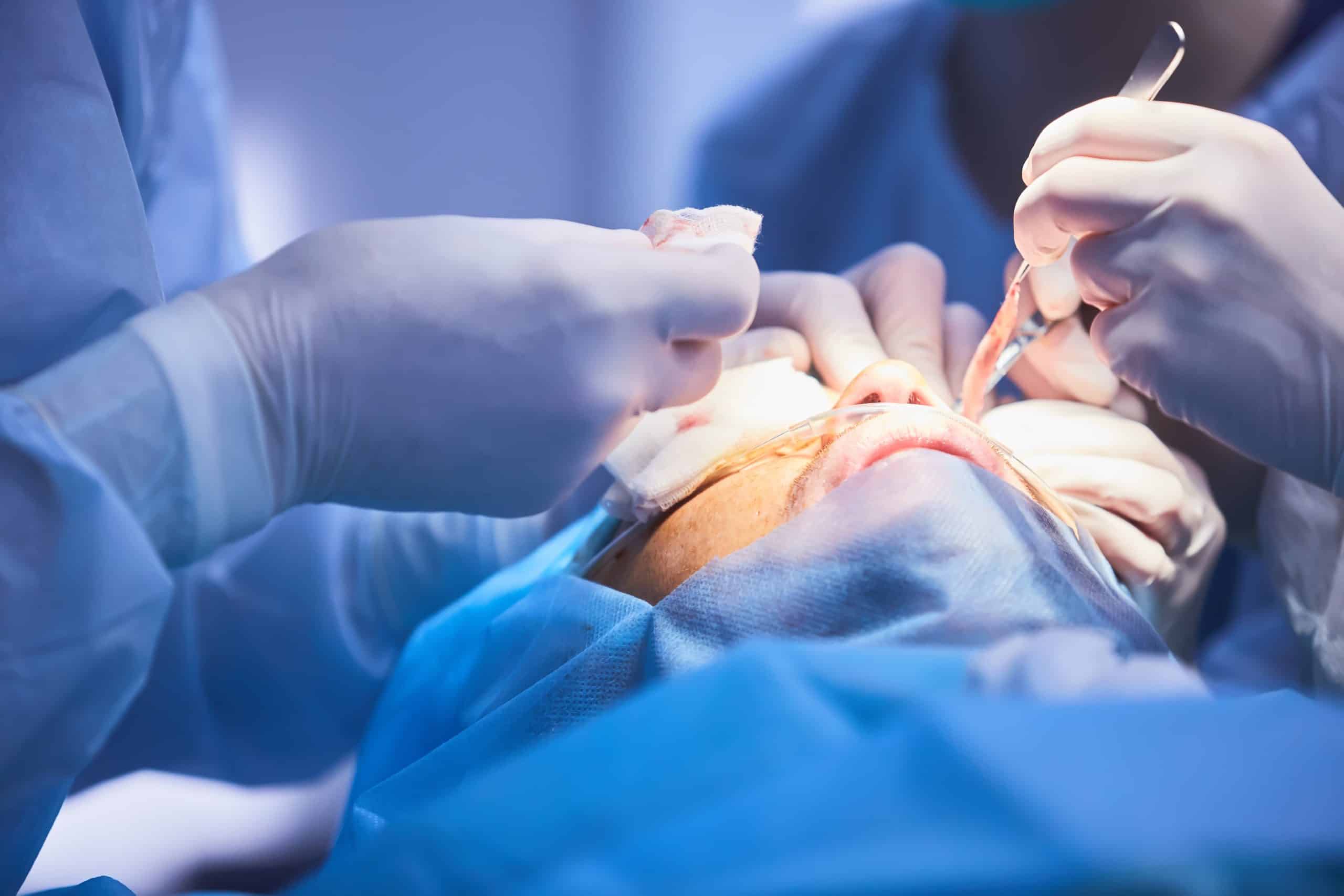 Tmj Replacement Surgery