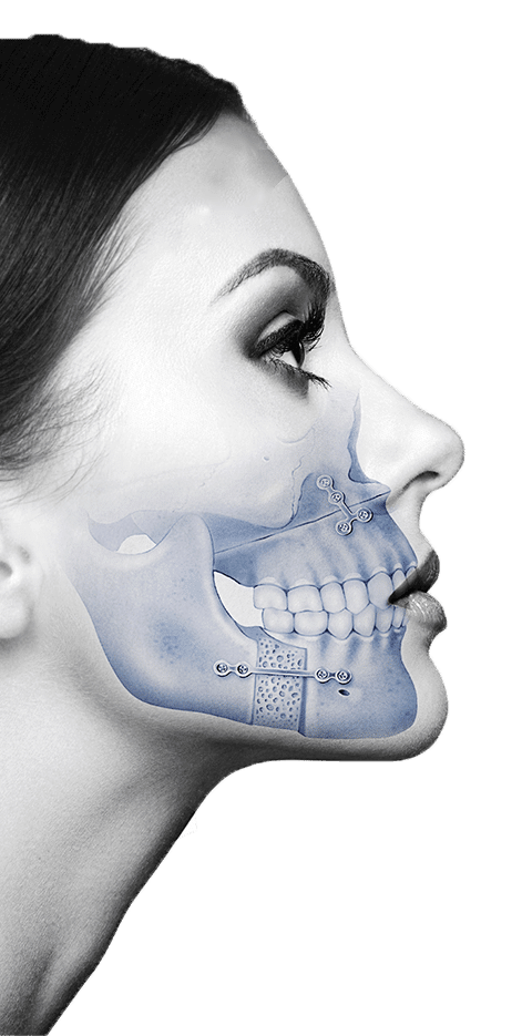 Oral and Maxillofacial Surgeon vs Orthognathic Surgeon