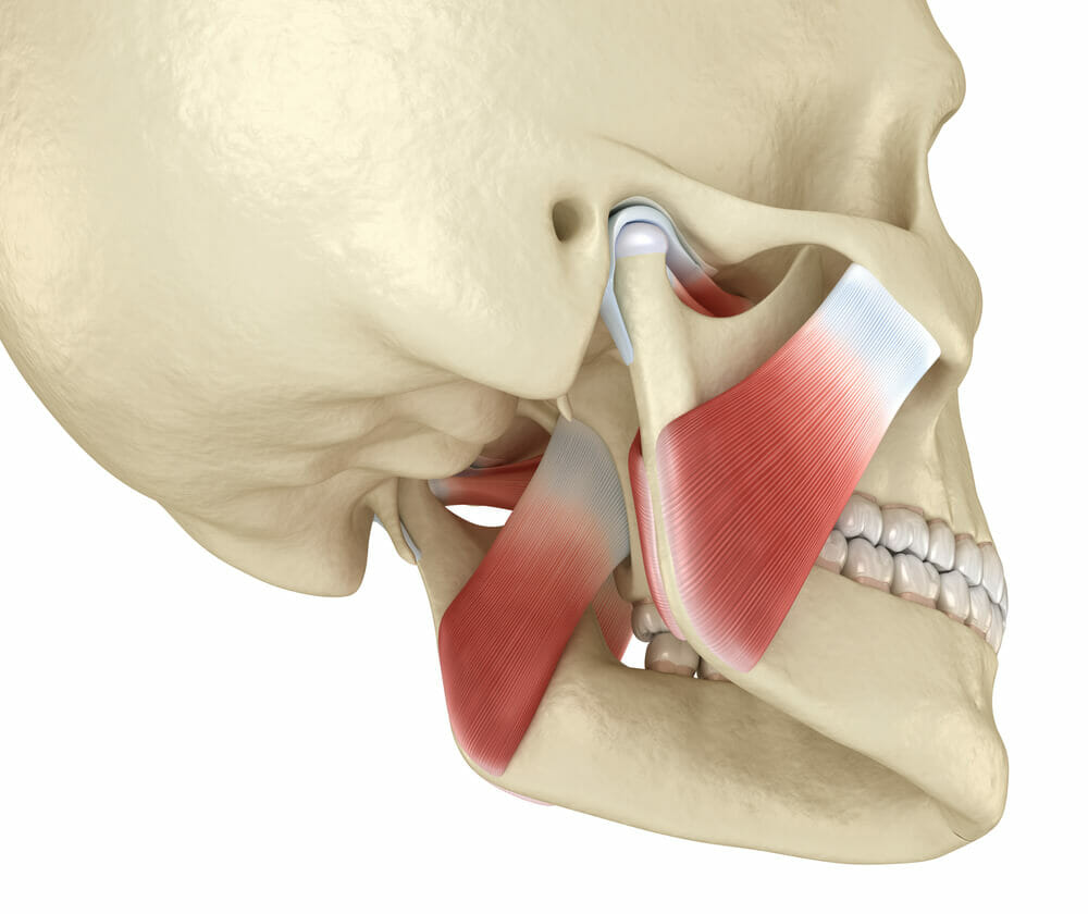 jaw revision surgery