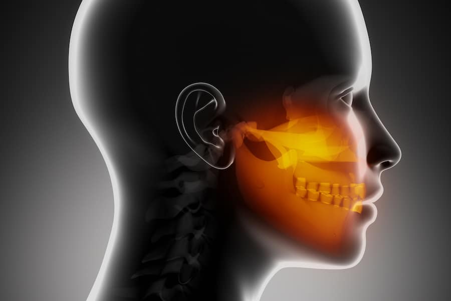 jaw revision surgery